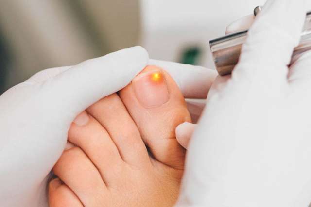 Solace Foot Health & Reflexology - Nail fungus is a common condition. If  you have toenail fungus, one or more of your toenails may become: 🦠  Discoloured, usually white or yellow 🦠